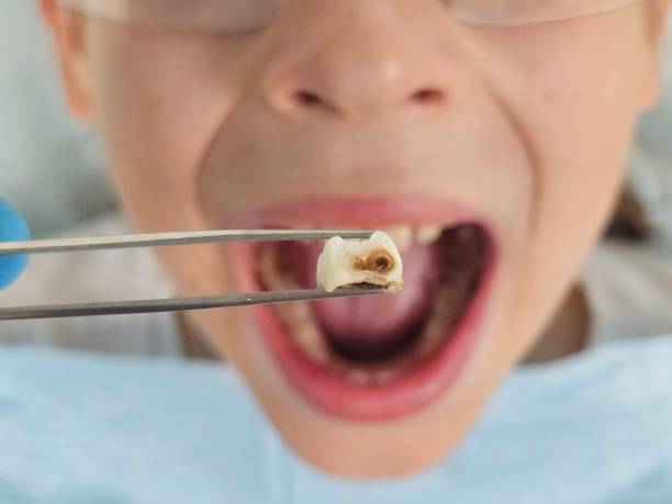 Best Pediatric Emergency Dentist in Mooresville, IN